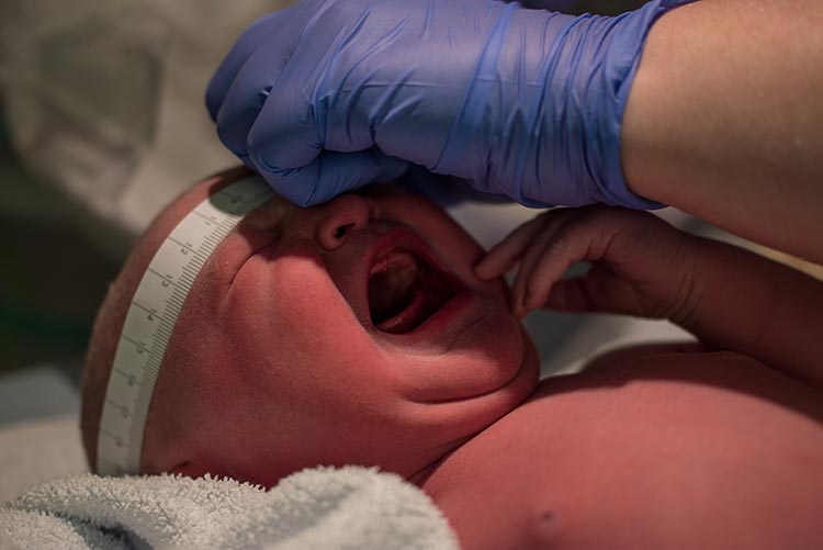 A newborn's head circumference being measured.