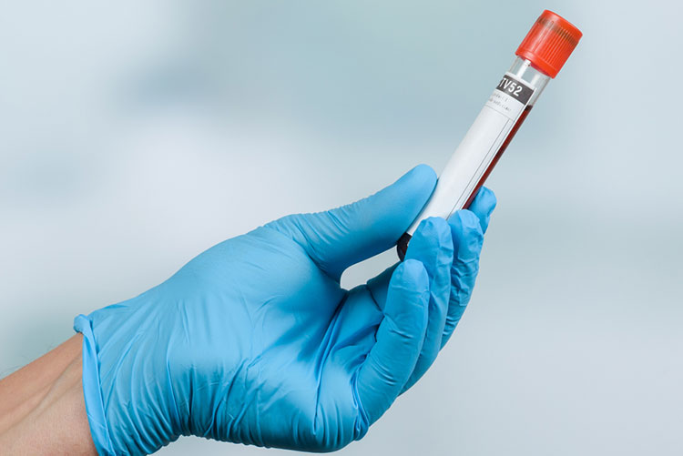 Gloved hand holding a test tube which contains a blood sample