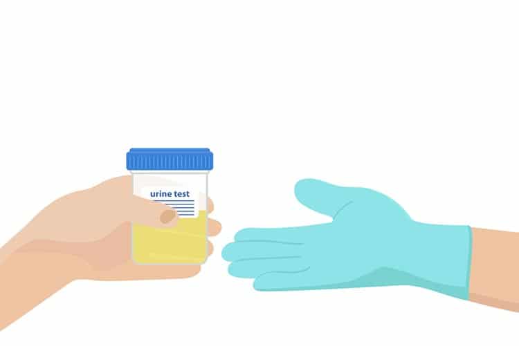 Vector image of a person handing out a urine sample in a bottle to a gloved hand
