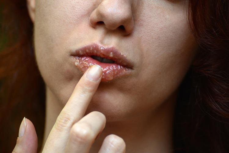 Woman exfoliating lips with a sugar scrub
